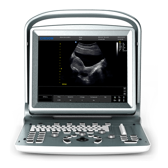 Узи аппарат Chison Sonotouch 20 (ECO 5)