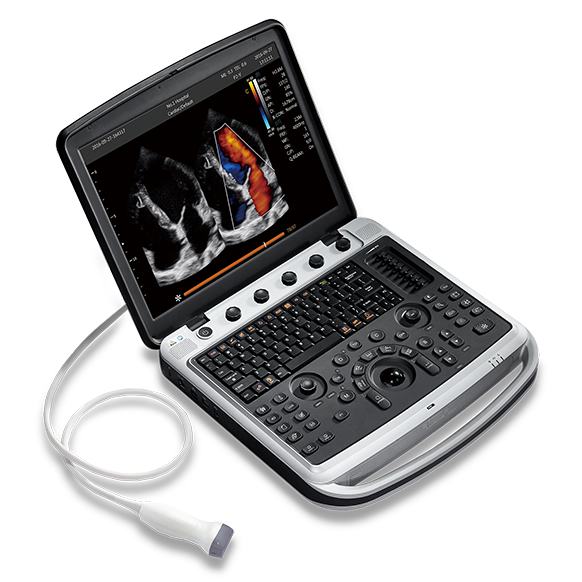 Узи аппарат Chison Sonotouch 80 (SonoBook 9)