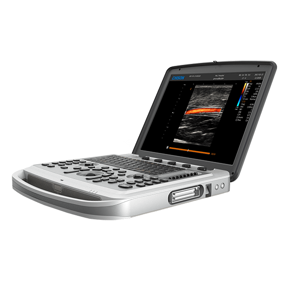 Узи аппарат Chison Sonotouch 80 (SonoBook 6)