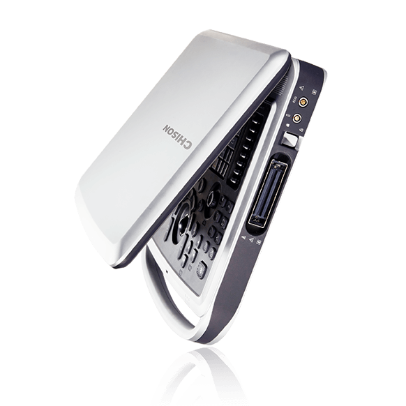 Узи аппарат Chison Sonotouch 80 (SonoBook 9)
