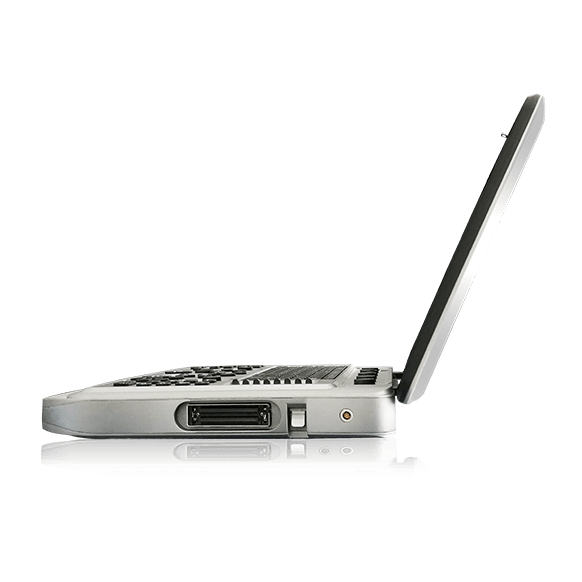 Узи аппарат Chison Sonotouch 80 (SonoBook 6)