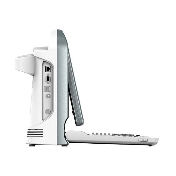 Узи аппарат Chison Sonotouch 20 (ECO 5)
