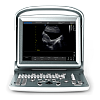 Узи аппарат Chison Sonotouch 20 (ECO 5)