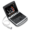 Узи аппарат Chison Sonotouch 80 (SonoBook 9)