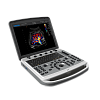Узи аппарат Chison Sonotouch 80 (SonoBook 6)