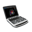 Узи аппарат Chison Sonotouch 80 (SonoBook 6)